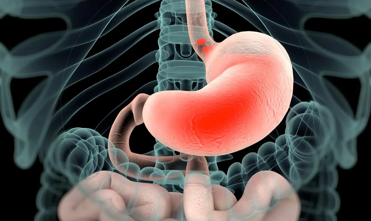 Stomaco irritato o gonfio? Ecco le bevande che ti danno sollievo immediato